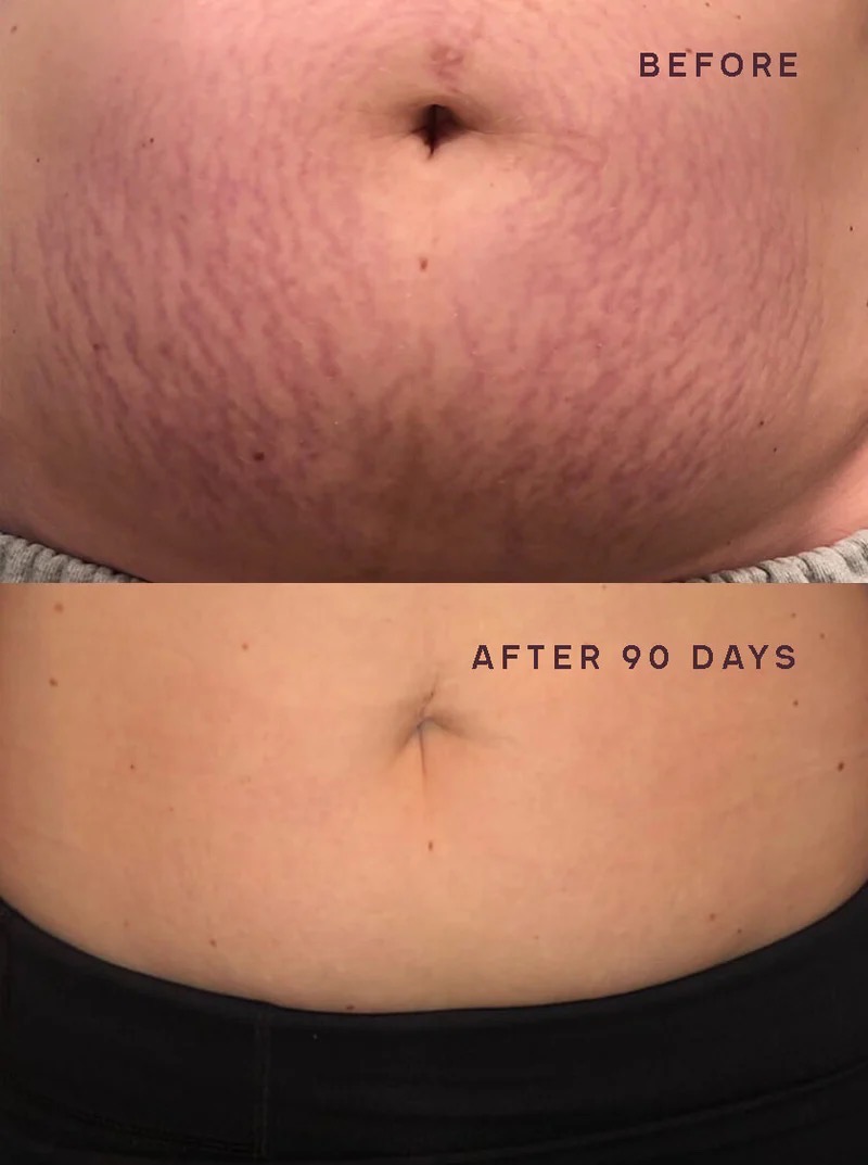 Salt Facial Before & After 3
